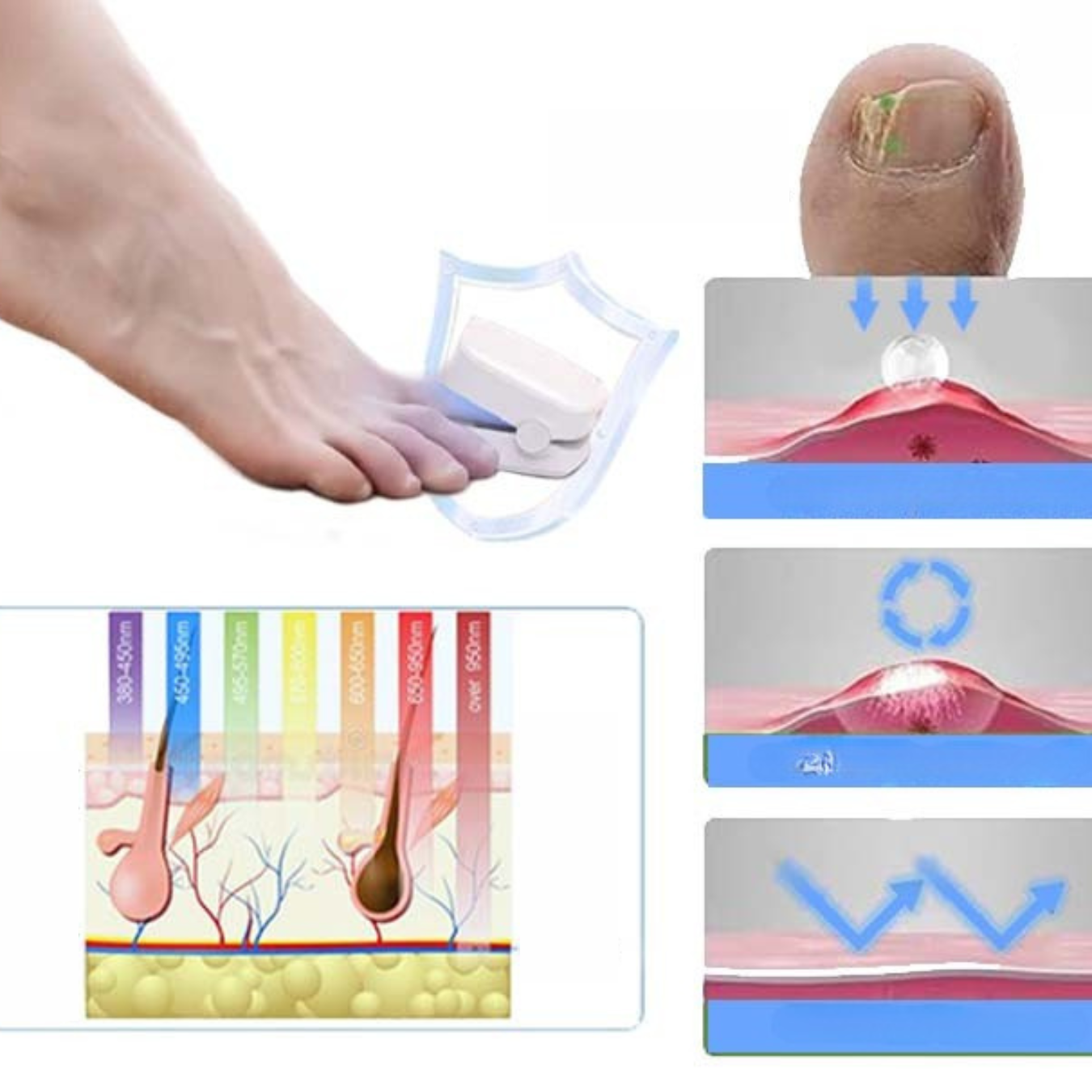 NailCure LED Lichtbehandeling | Voor gezonde & verzorgde teennagels