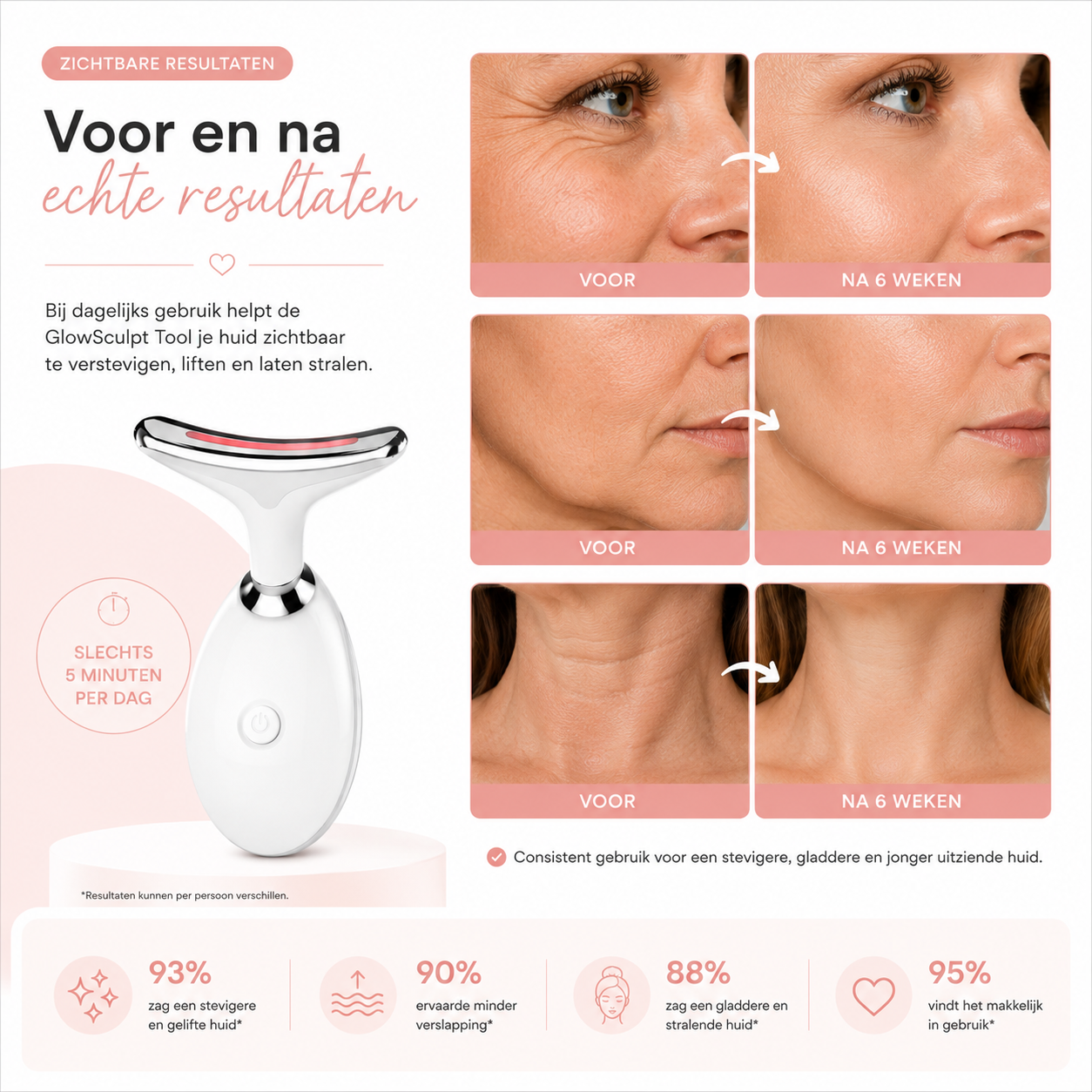Fittershape GlowSculpt Wand | LED Gezichtstool – Voor Stevigere Huid