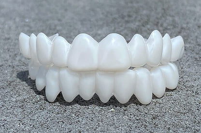 Tandenbeugel set – op maat – witte esthetiek – voor mooie glimlach