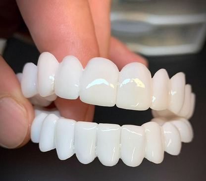 Tandenbeugel set – op maat – witte esthetiek – voor mooie glimlach
