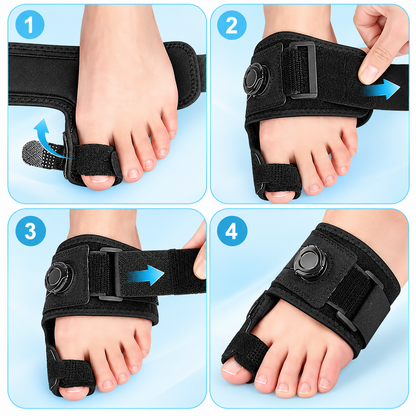 Fittershape Adjustable Bunion Corrector – verstelbaar & pijnverlichtend