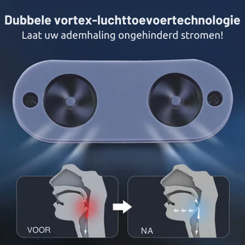 Slaap Snurkstopper – Oplaadbaar – Voor Beter Ademhalen – Voor Snurkers
