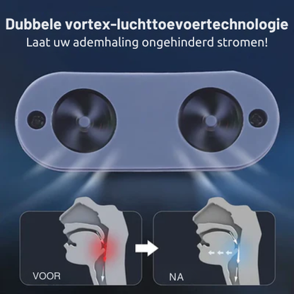 Slaap Snurkstopper – Oplaadbaar – Voor Beter Ademhalen – Voor Snurkers