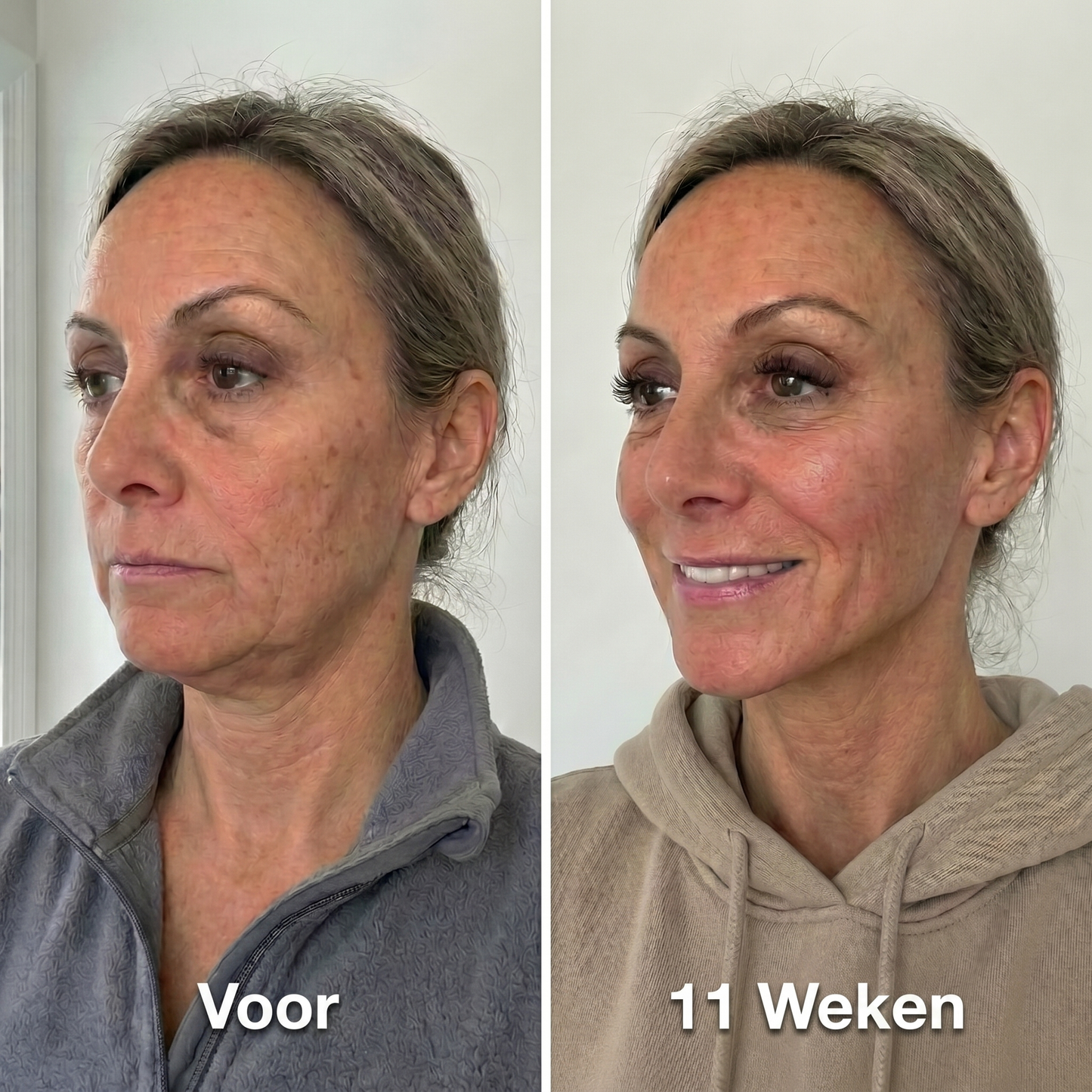 Fittershape Collagen Sculpt Masker