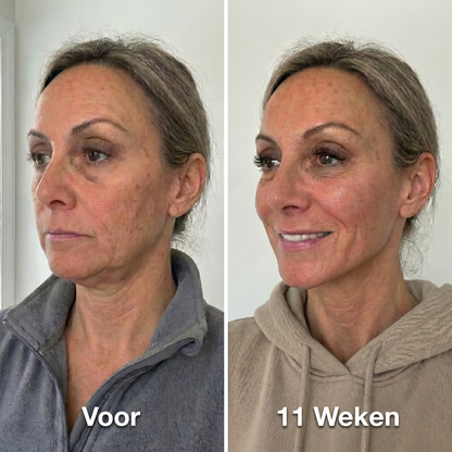 Fittershape Collagen Sculpt Masker