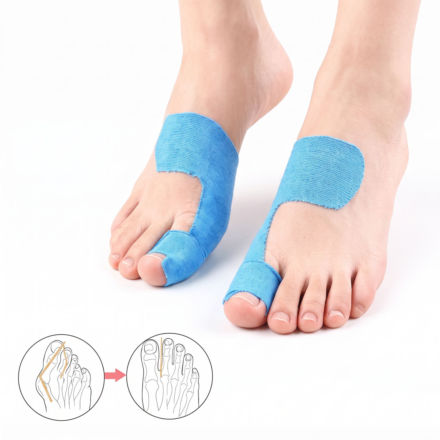 Fittershape BunionCorrect Tape