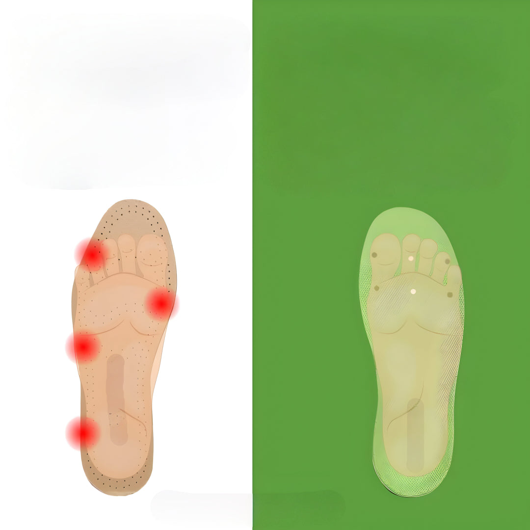 Orthopedische inlegzolen – Verstelbare Drukverlichting – Voor Voetpijn